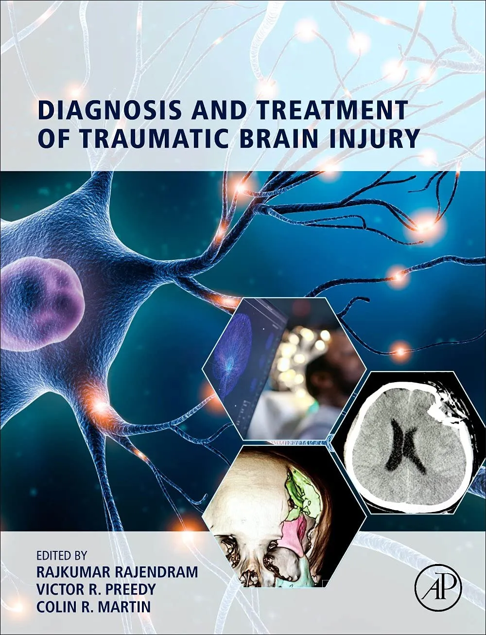 Diagnosis And Treatment Of Traumatic Brain Injury | Hardcover