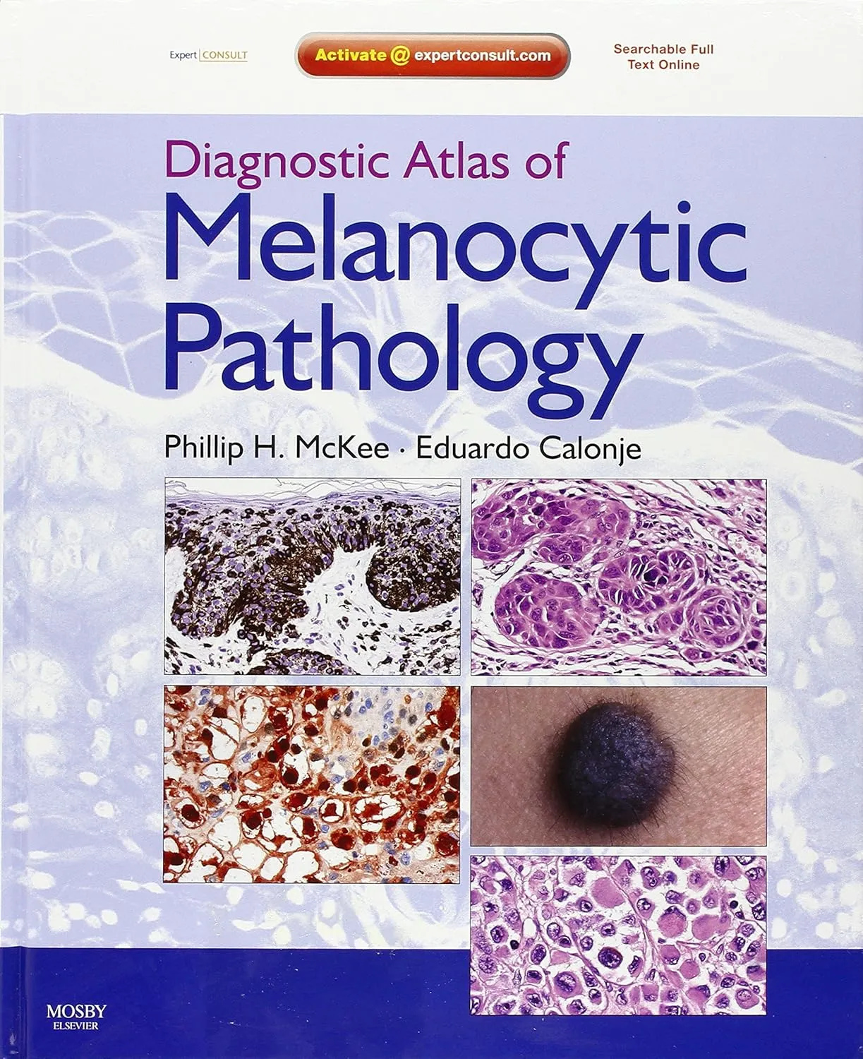 Diagnostic Atlas of Melanocytic Pathology | Hardcover