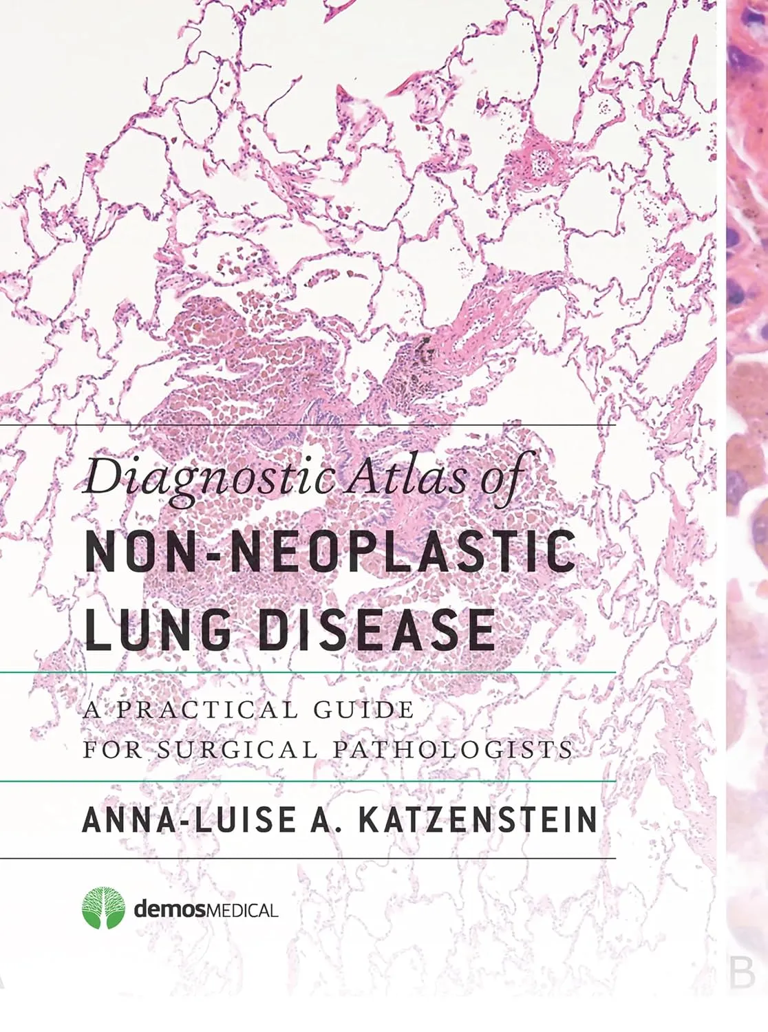 Diagnostic Atlas of Non-Neoplastic Lung Disease | Hardcover
