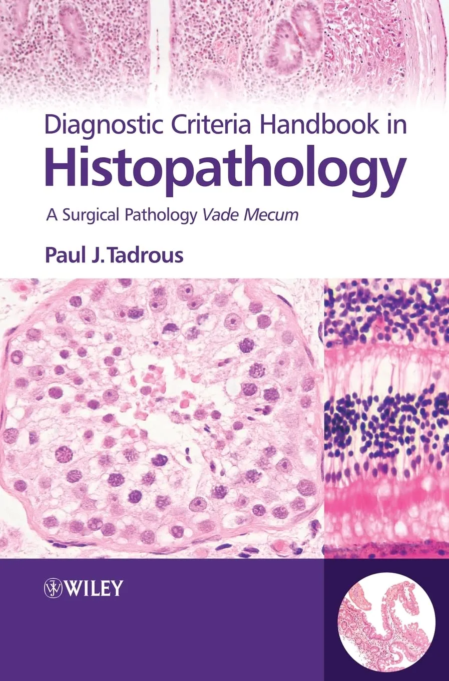 Diagnostic Criteria Handbook in Histopathology A Surgical Pathology Vade Mecum | Hardcover