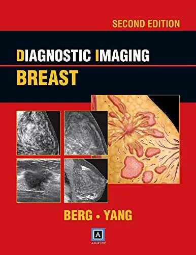 Diagnostic Imaging Breast | 2nd Edition | Hardcover