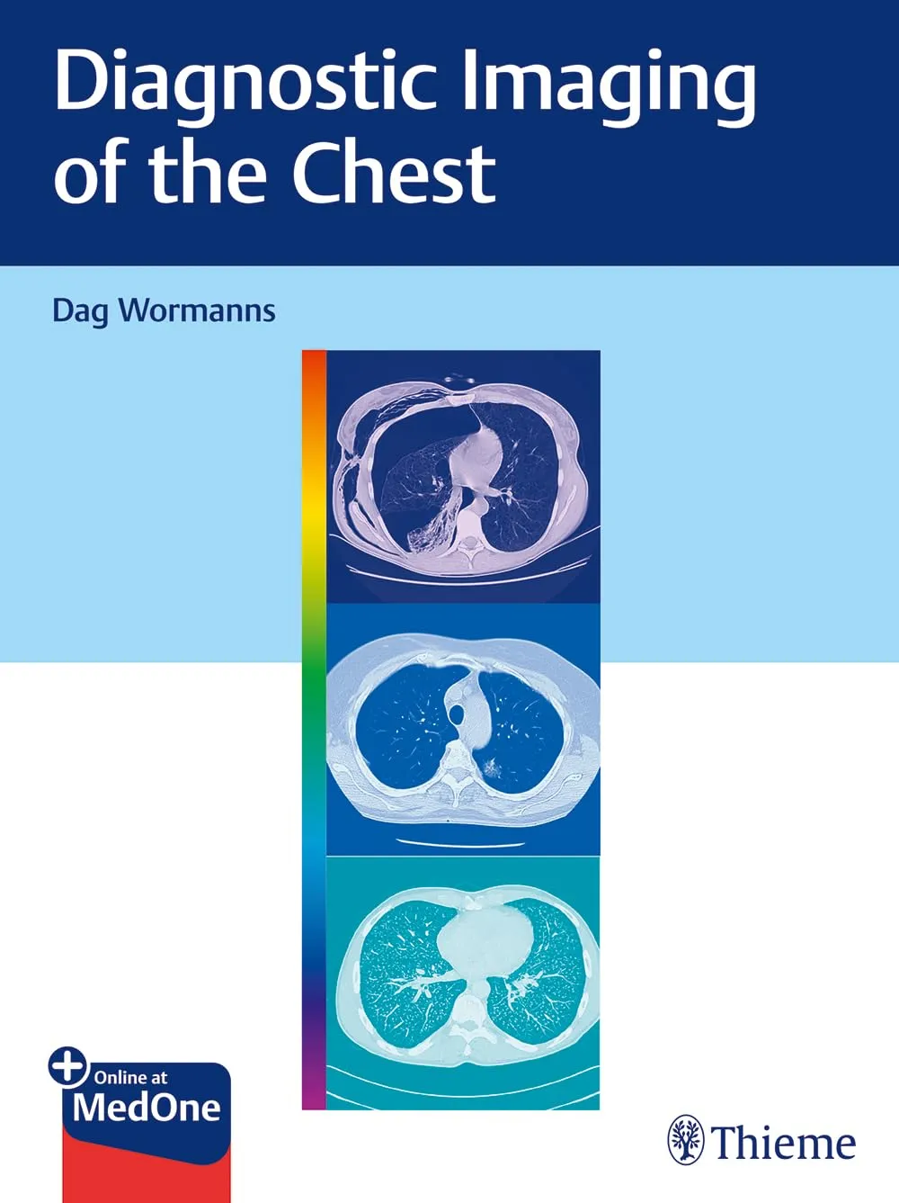 Diagnostic Imaging of the Chest | Hardcover