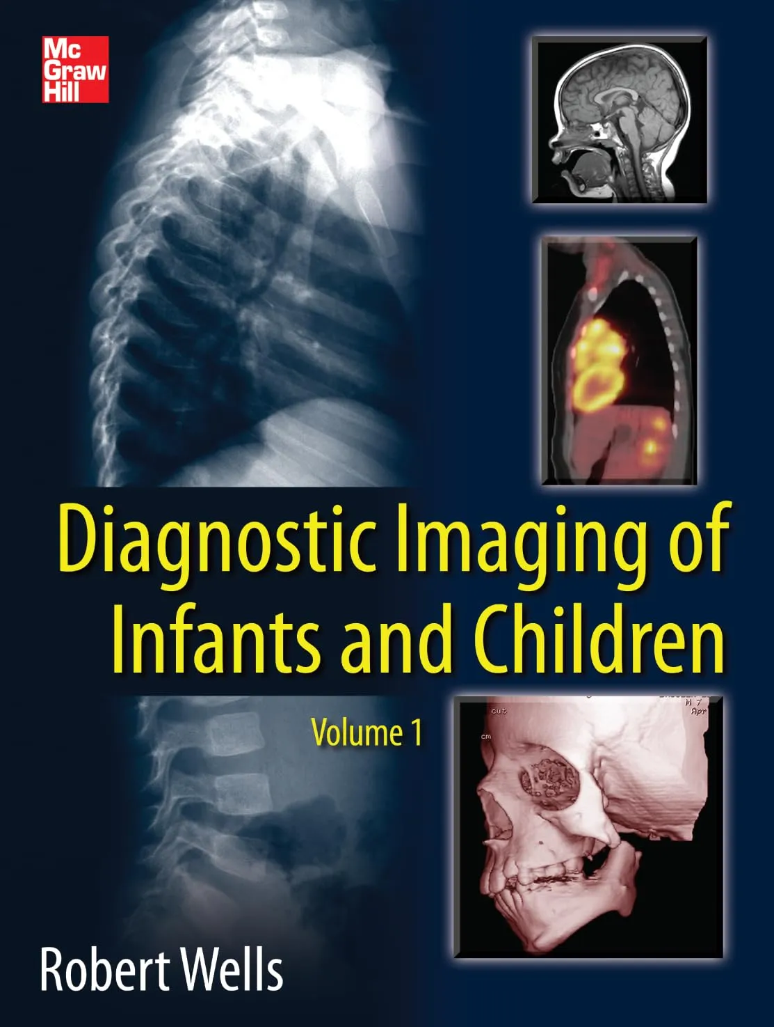 Diagnostic Imaging of Infants and Children | 2 Vol Set | Hardcover