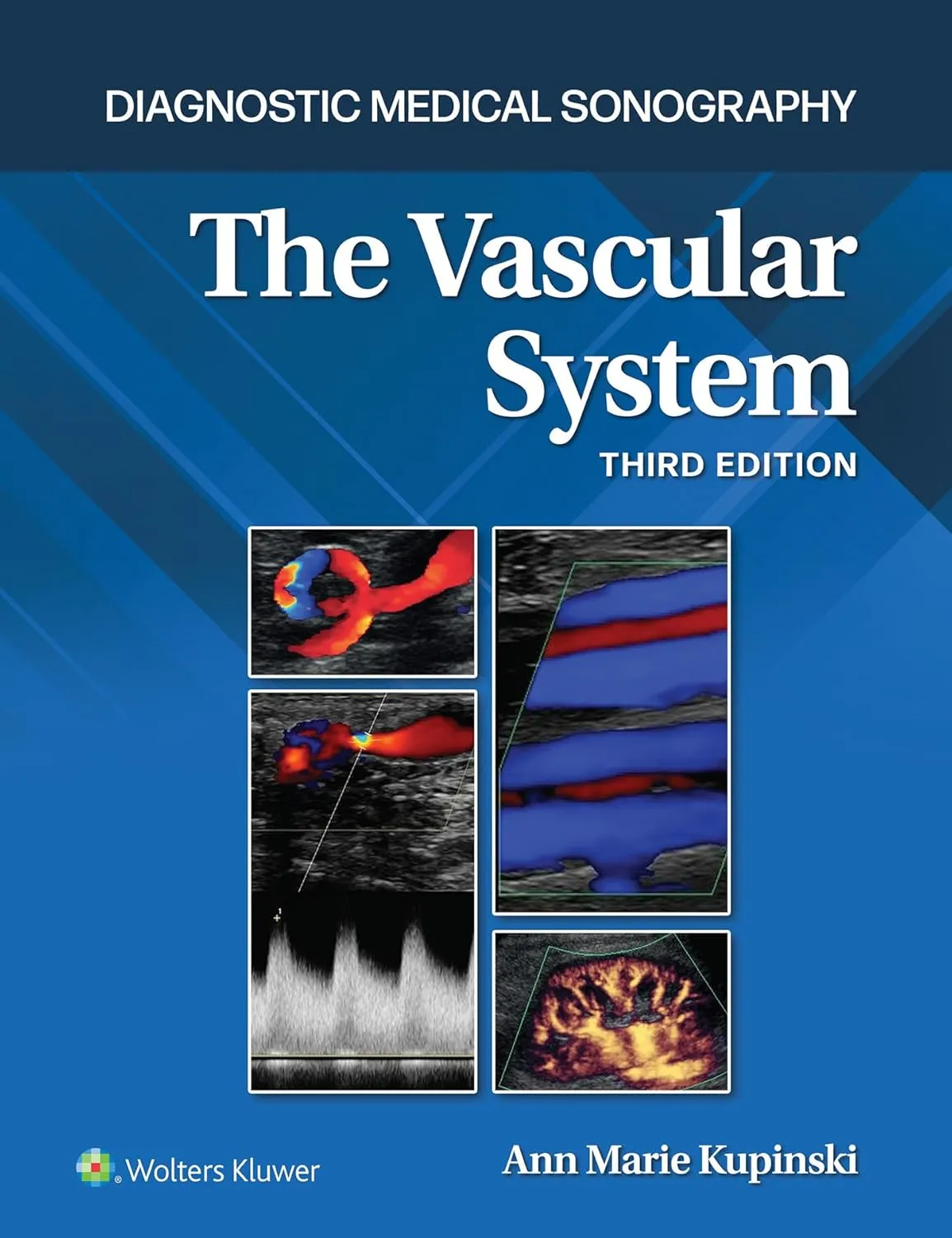 Diagnostic Medical Sonography The Vascular System Third Edition | Hardcover