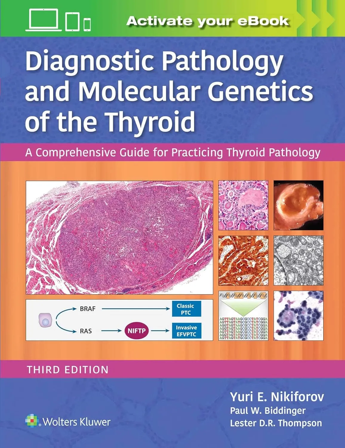 Diagnostic Pathology and Molecular Genetics of the Thyroid | Third Edition | Hardcover