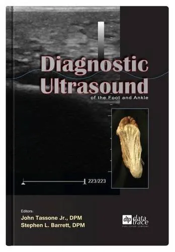 Diagnostic Ultrasound of the Foot and Ankle | Hardcover