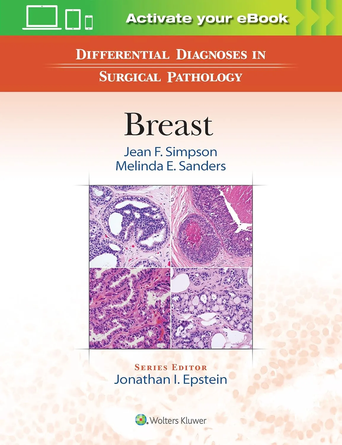 Differential Diagnoses in Surgical Pathology Breast | Hardcover