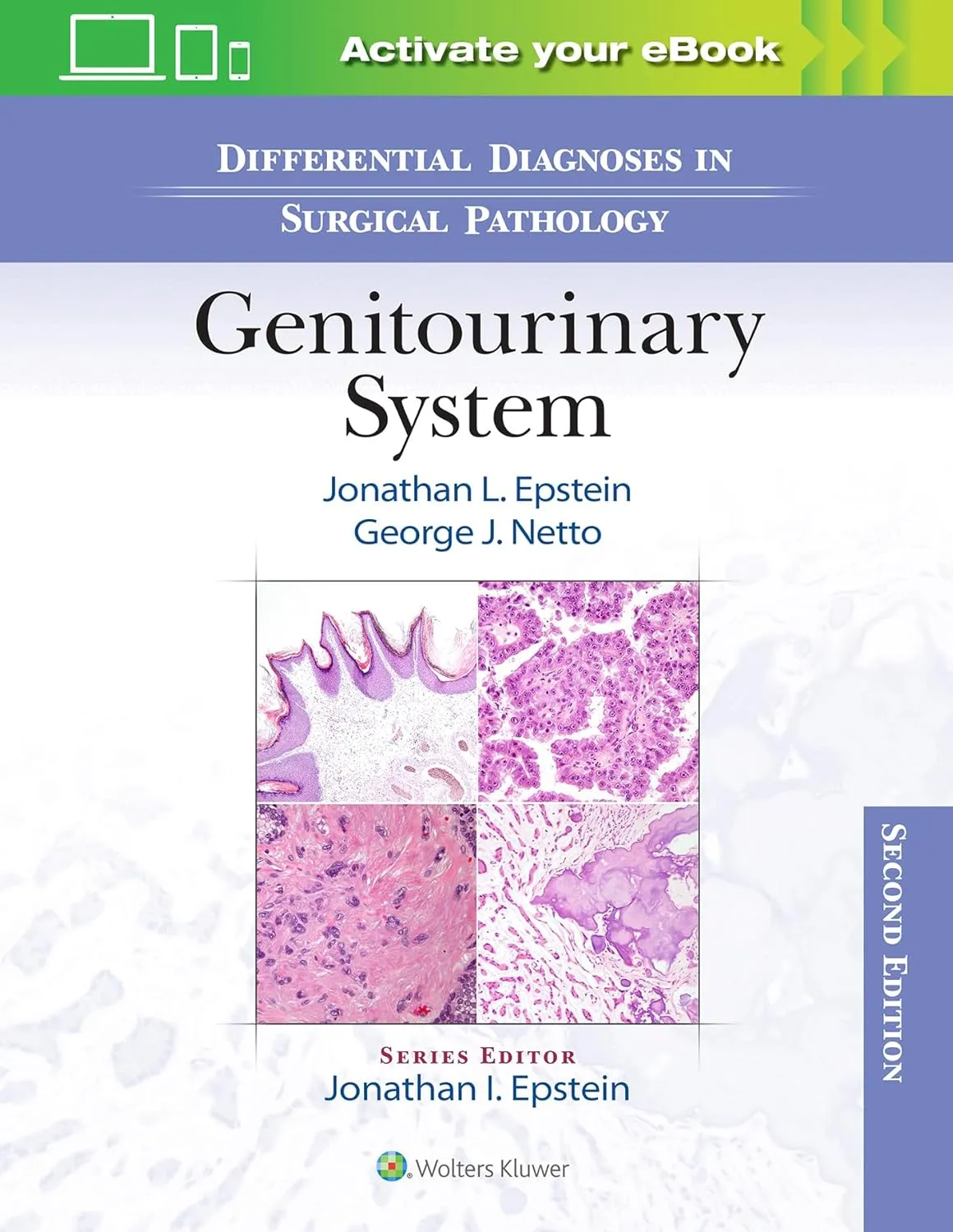 Differential Diagnoses In Surgical Pathology Genitourinary System 2nd Edition | Hardcover