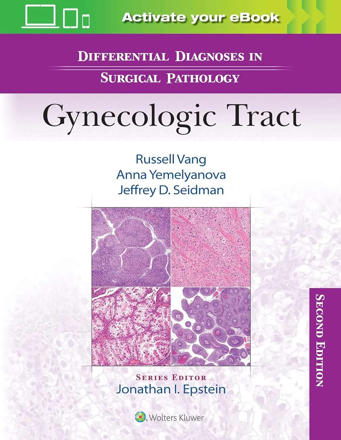 Differential Diagnoses In Surgical Pathology Gynecologic Tract With Access Code 2nd Edition | Hardcover