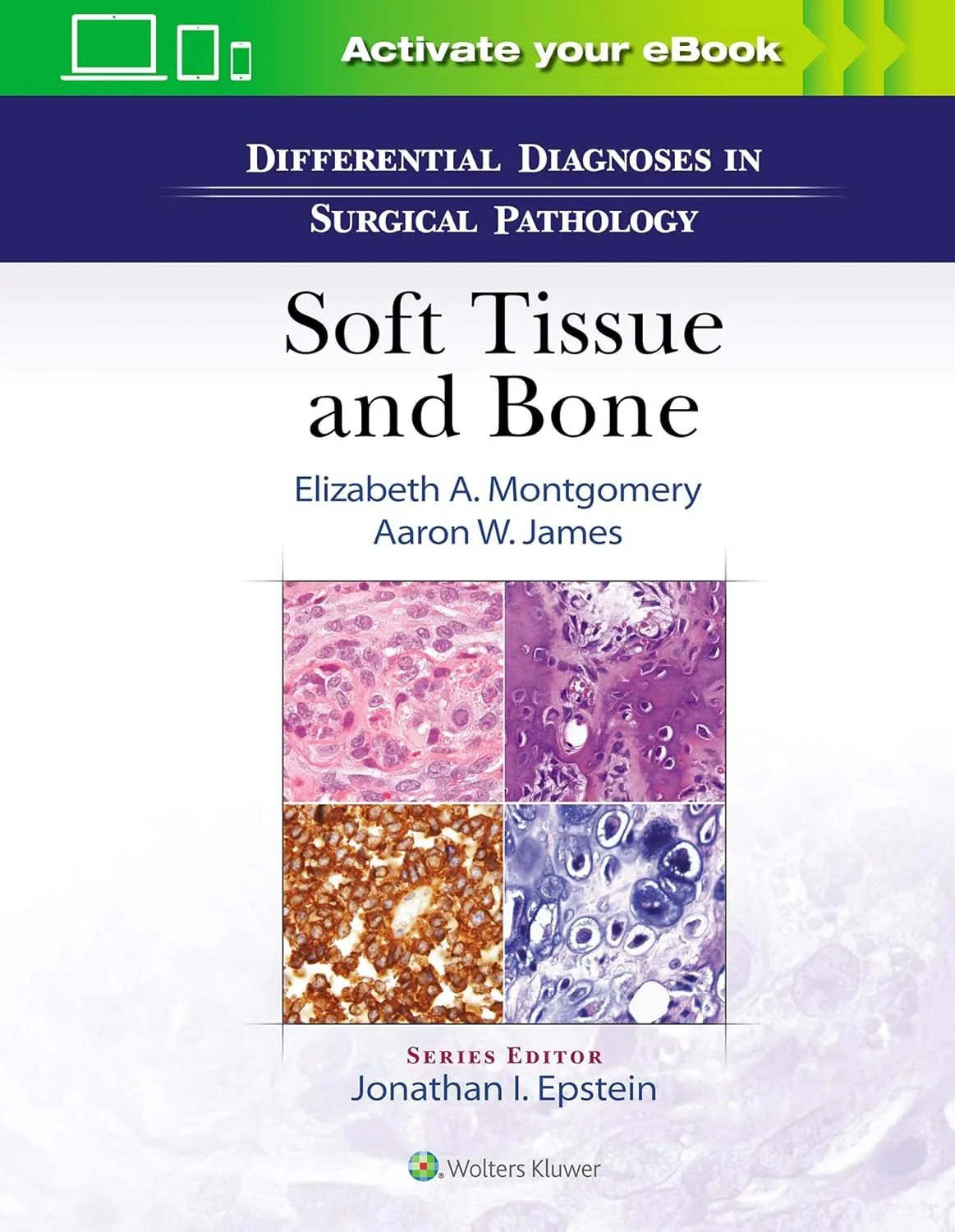 Differential Diagnoses In Surgical Pathology Soft Tissue and Bone | Hardcover