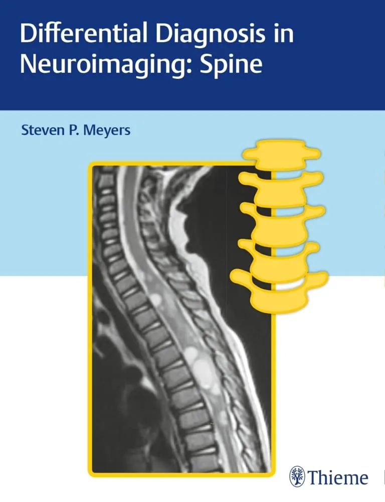 Differential Diagnosis in Neuroimaging Spine | Hardcover