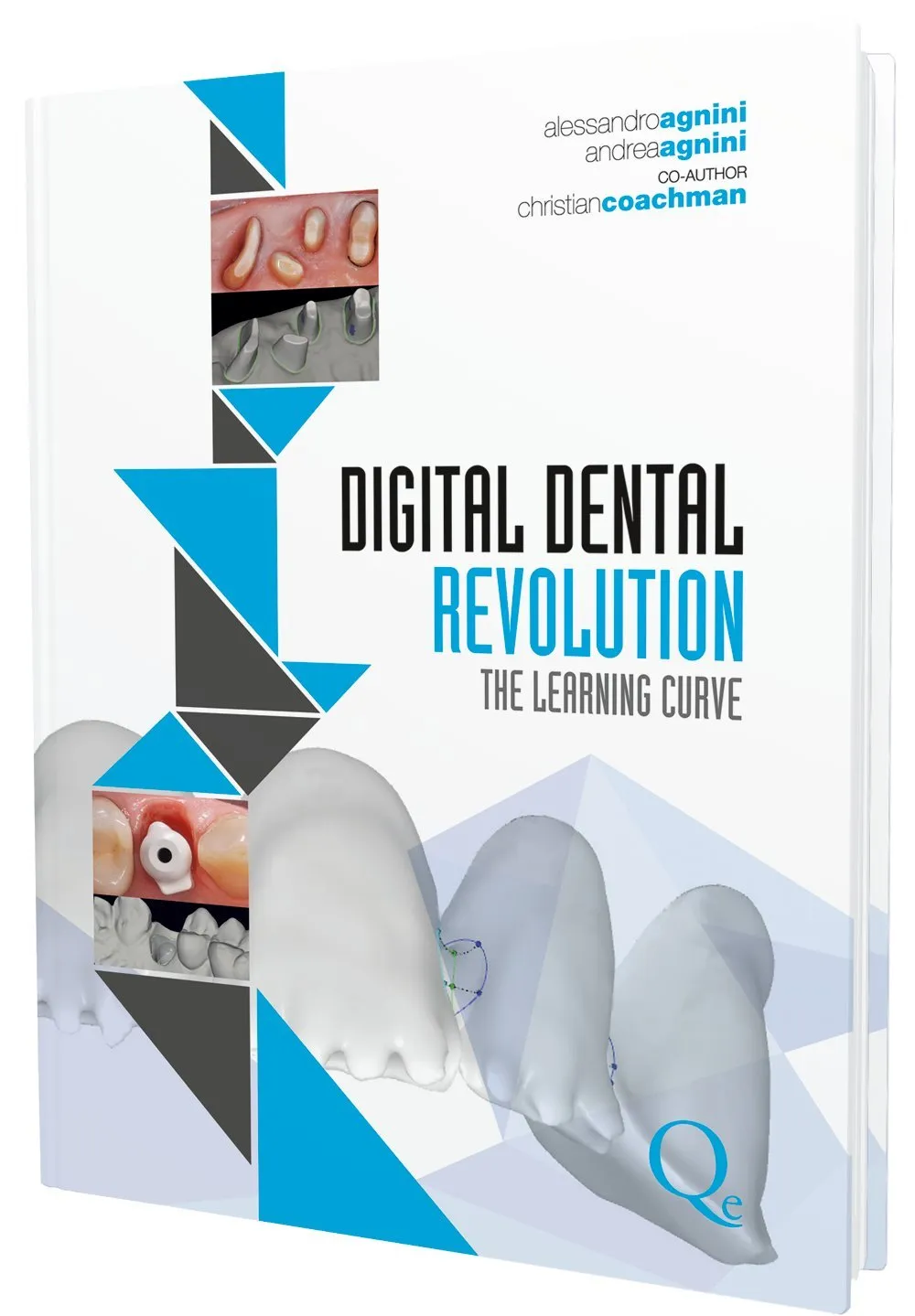 Digital Dental Revolution The Learning Curve | Hardcover