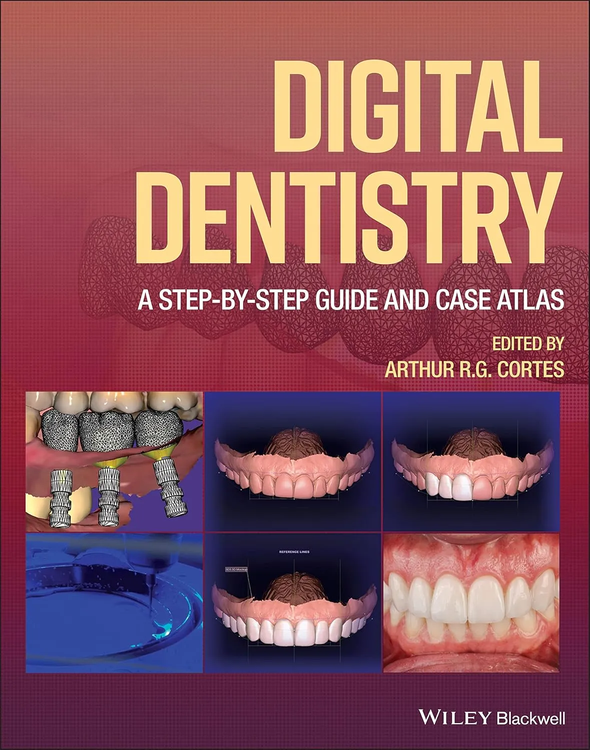 Digital Dentistry A Step By Step Guide And Case Atlas | Hardcover