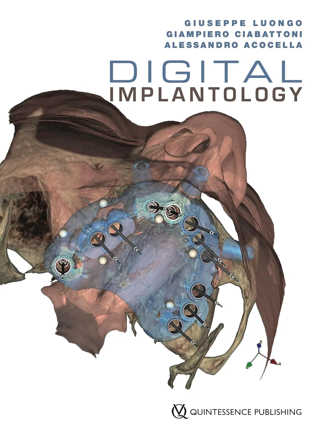 Digital Implantology | Hardcover