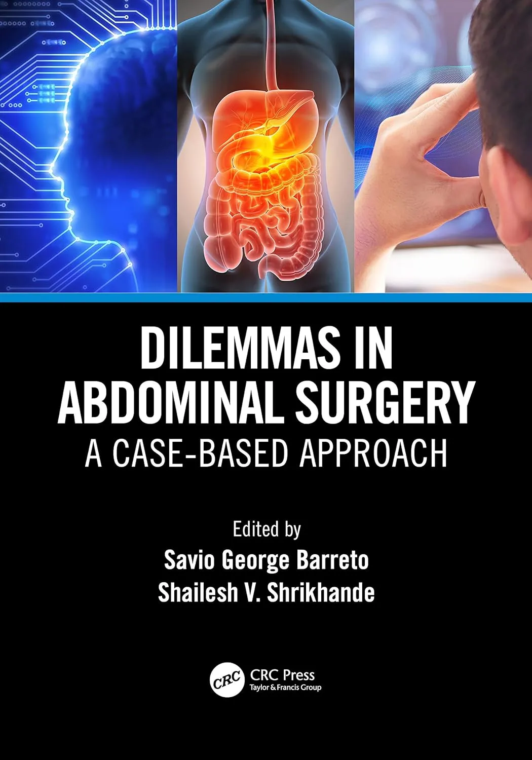 Dilemmas In Abdominal Surgery A Case Based Approach | Paperback