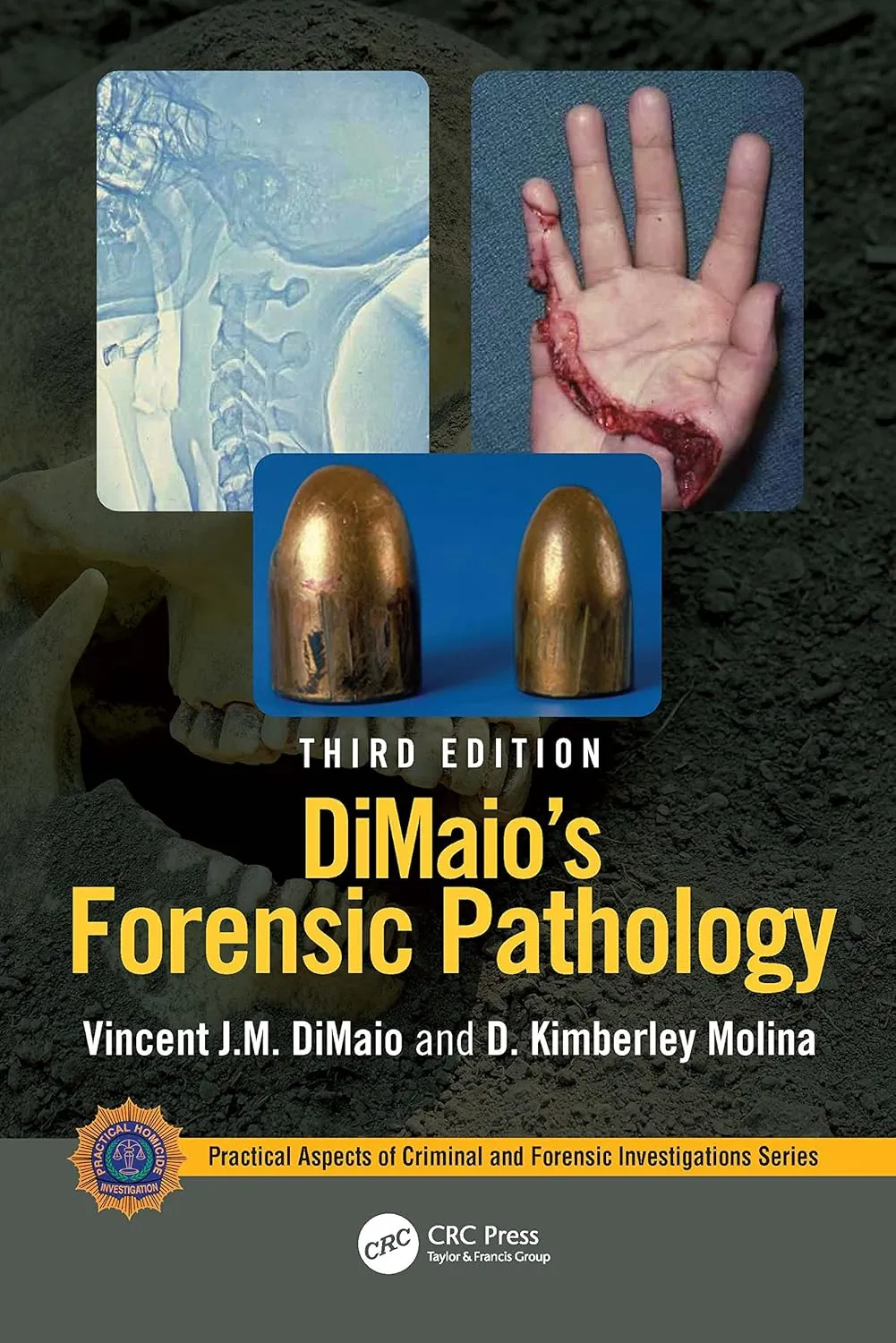 Dimaios Forensic Pathology Third Edition | Hardcover