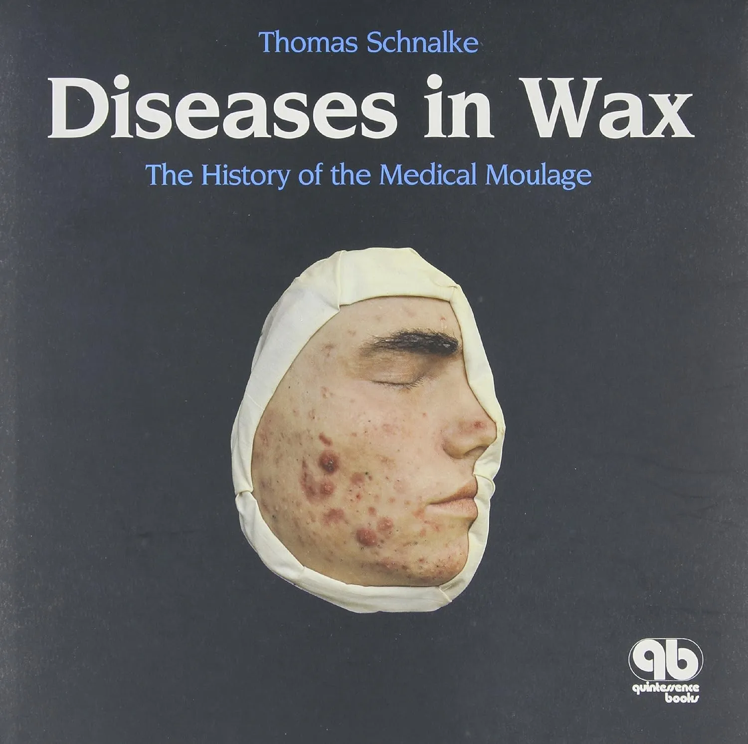 Diseases in Wax The History of the Medical Moulage | Hardcover