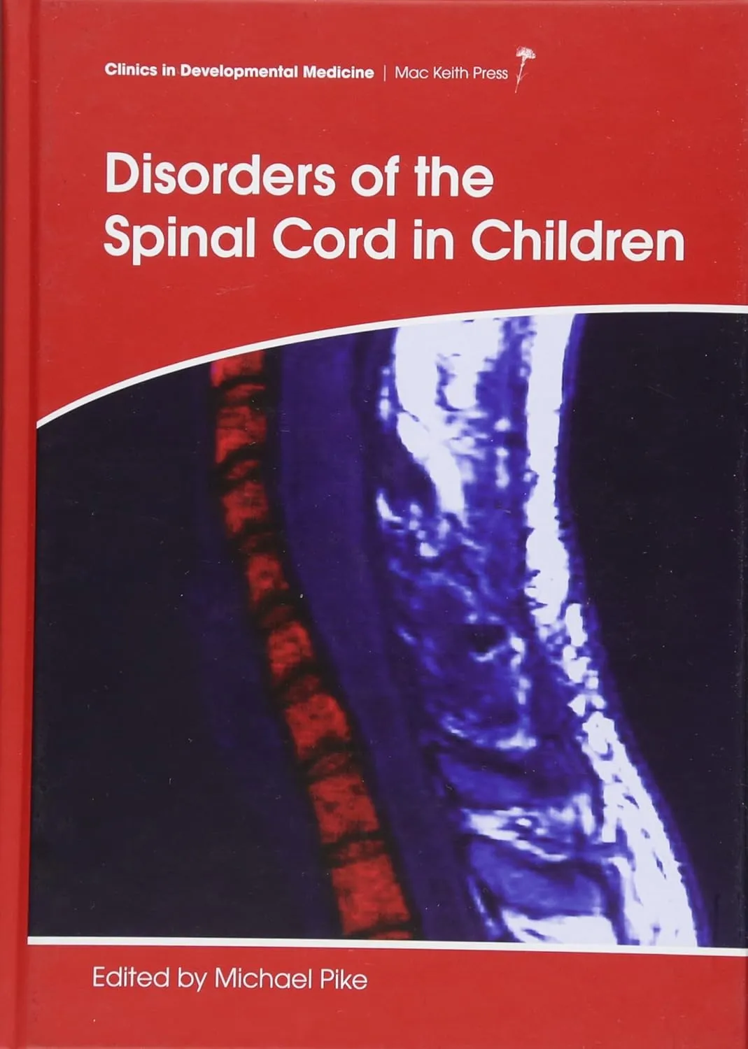 Disorders of the Spinal Cord in Children | Hardcover