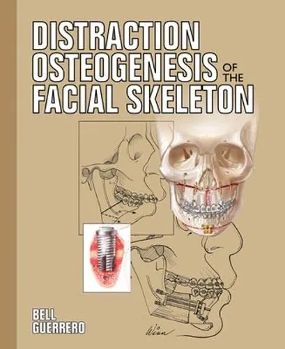 Distraction Osteogenesis of the Facial Skeleton With CD | Hardcover