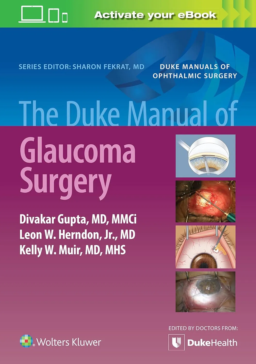 The Duke Manual Of Glaucoma Surgery | Paperback