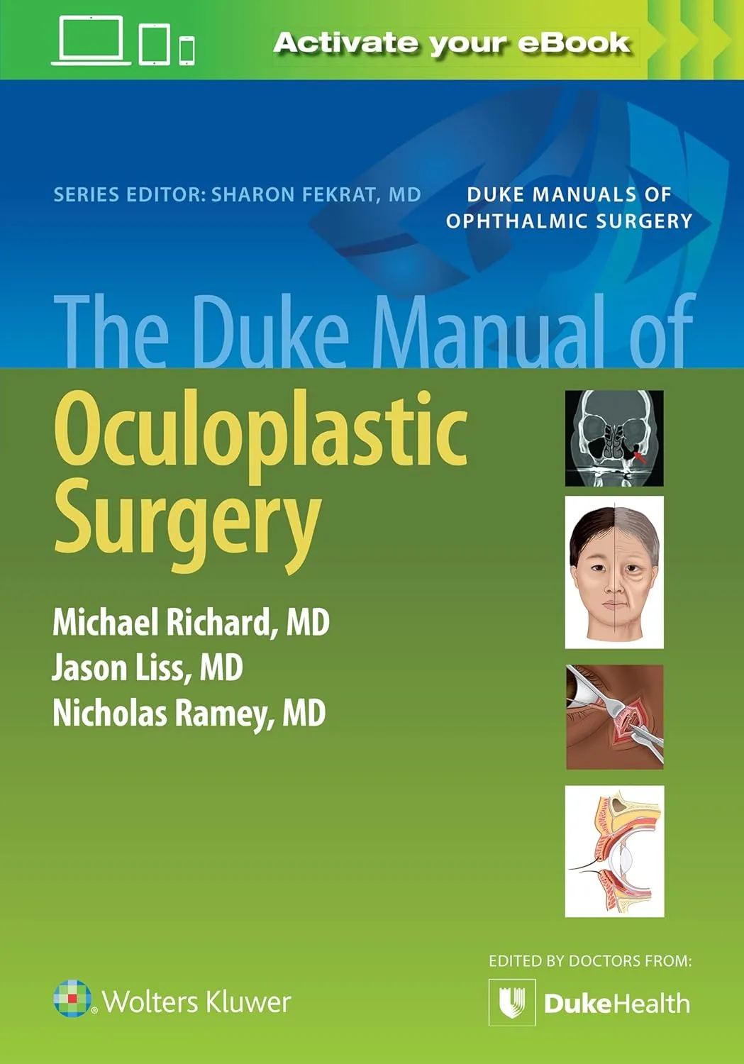The Duke Manual Of Oculoplastic Surgery | Paperback