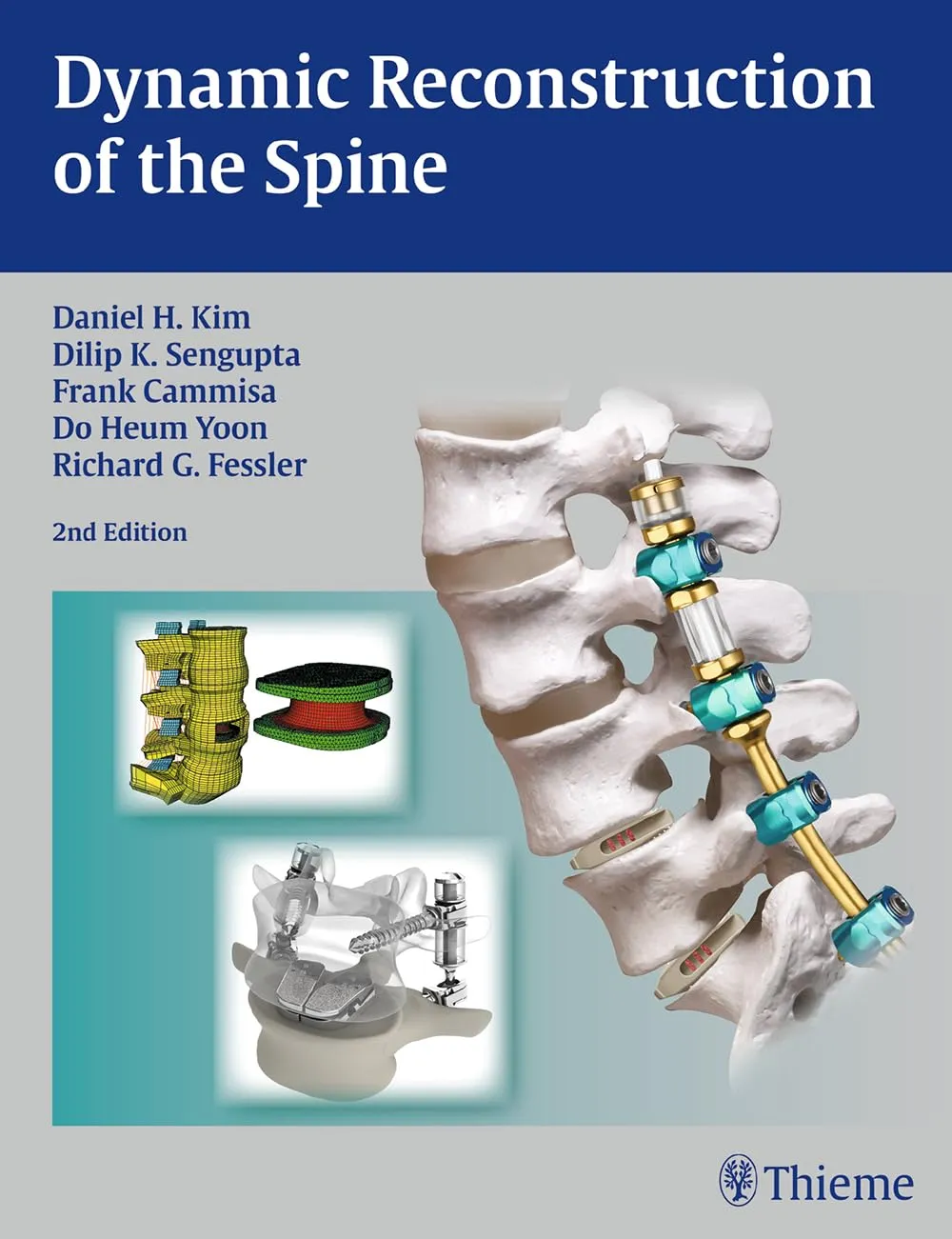 Dynamic Reconstruction of the Spine | 2nd Edition | Hardcover