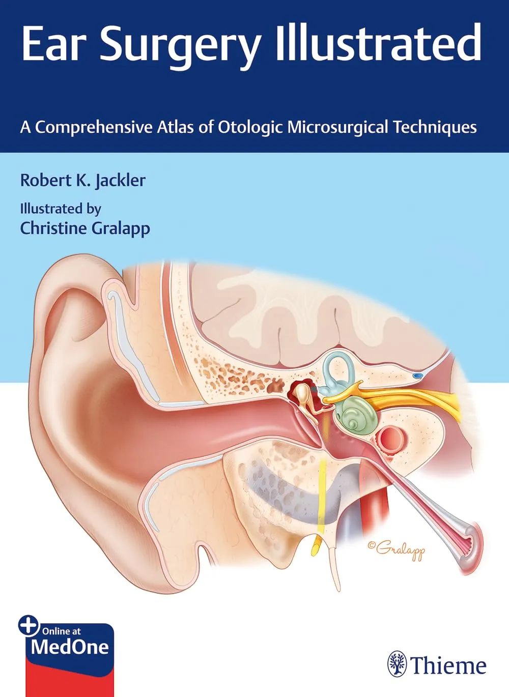 Ear Surgery Illustrated A Comprehensive Atlas of Otologic Microsurgical Techniques | Hardcover