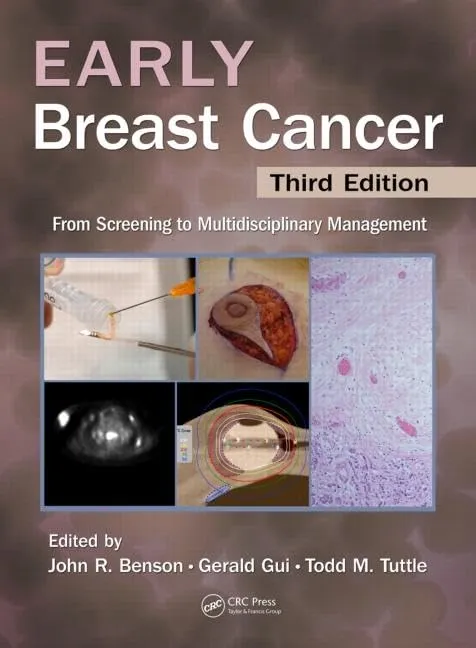 Early Breast Cancer | Third Edition | Hardcover