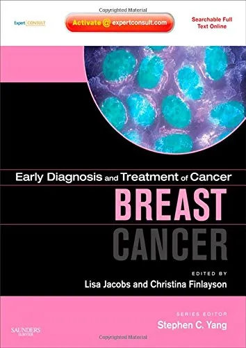 Early Diagnosis and Treatment of Cancer Breast Cancer | Hardcover