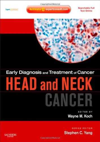 Early Diagnosis and Treatment of Cancer Head and Neck Cancer | Hardcover