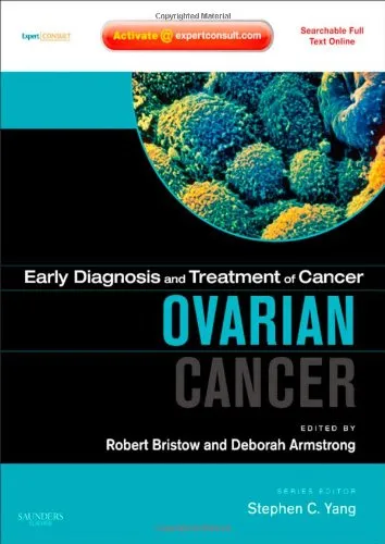 Early Diagnosis and Treatment of Cancer Ovarian Cancer | Hardcover