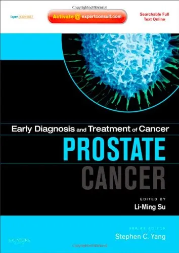 Early Diagnosis and Treatment of Cancer Prostate Cancer | Hardcover
