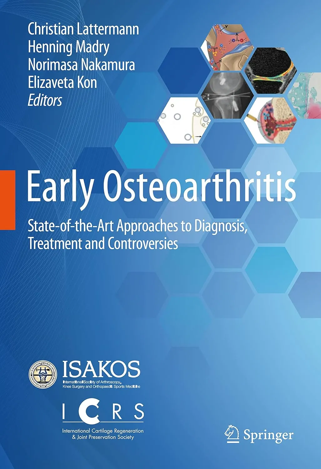 Early Osteoarthritis State Of The Art Approaches To Diagnosis Treatment And Controversies | Hardcover