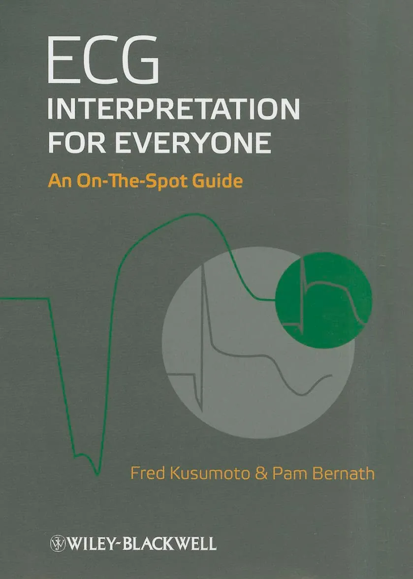 ECG Interpretatlion for Everyone An On-The-Spot Guide | Paperback