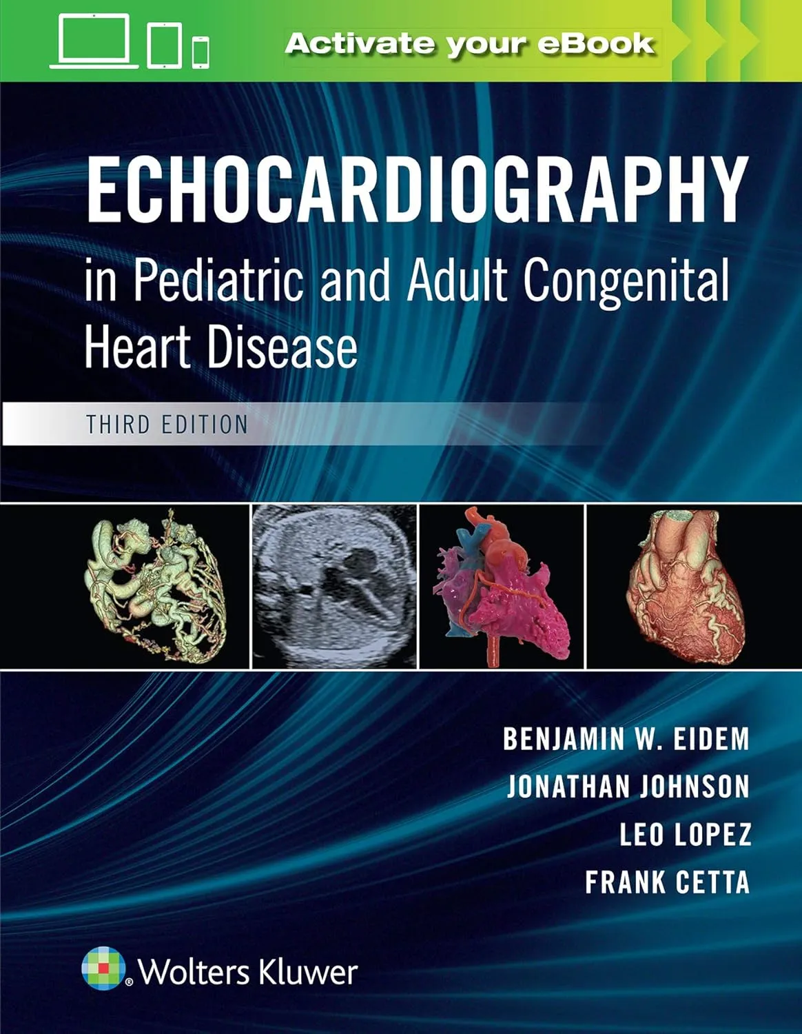 Echocardiography In Pediatric And Adult Congenital Heart Disease | Third Edition | Hardcover