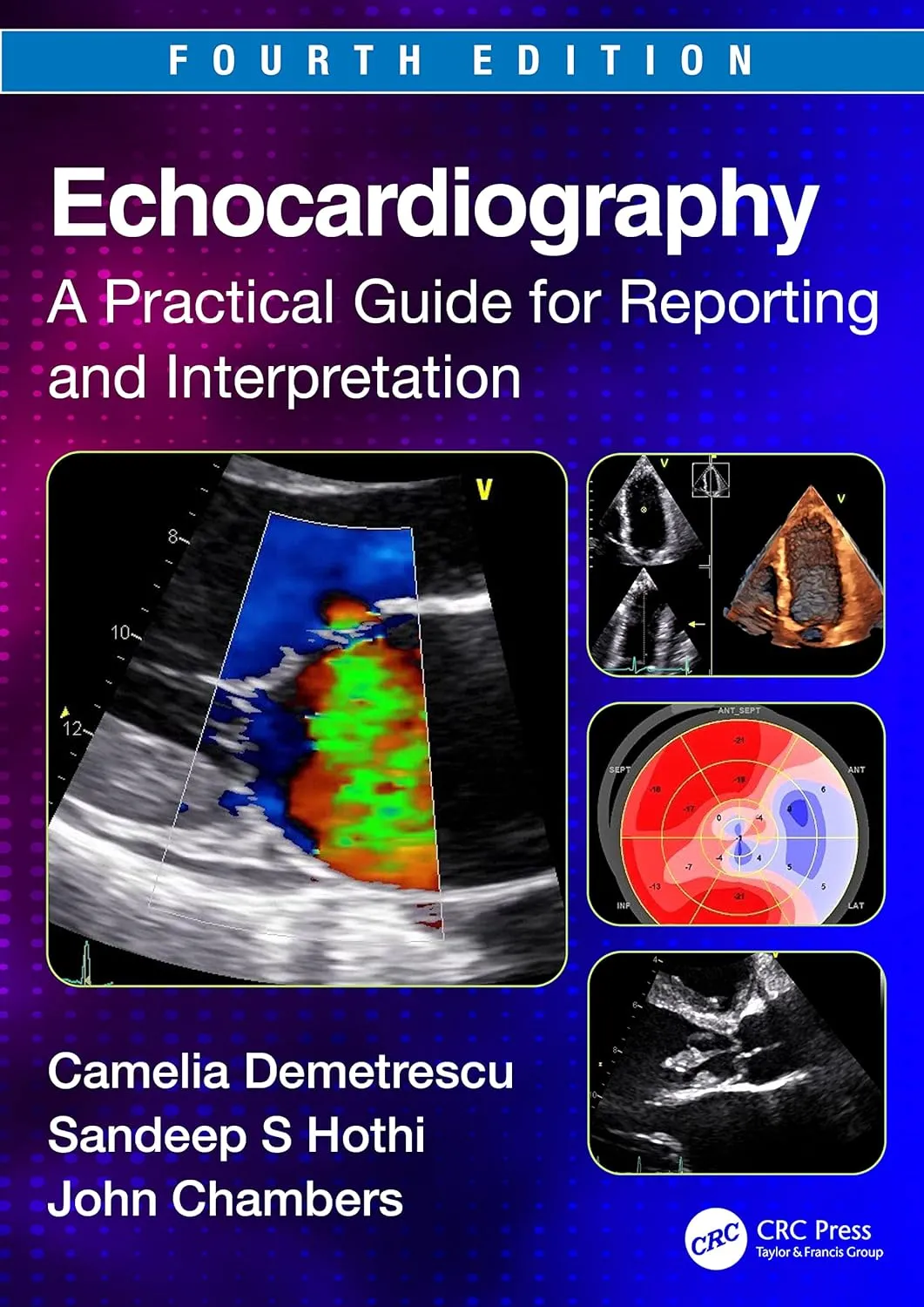 Echocardiography A Practical Guide For Reporting And Interpretation 4th Edition | Paperback