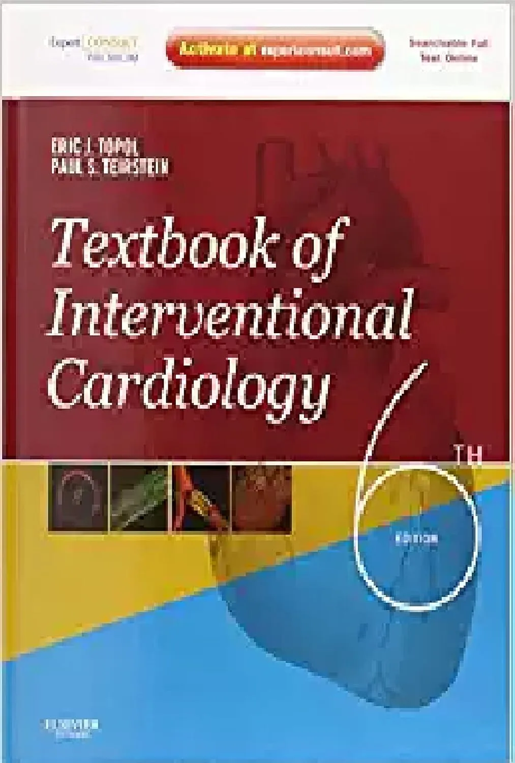 Echocardiography Update Pre Clinical Atherosclerosis and Cornonary Artery Disease | Volume 2 | Paperback