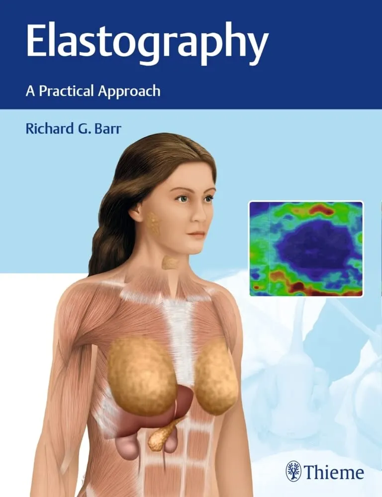 Elastography A Practical Approach | Hardcover