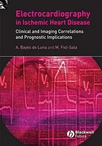 Electrocardiography in Ischemic Heart Disease Clinical and Imaging Correlations and Prognostic Implications | Hardcover