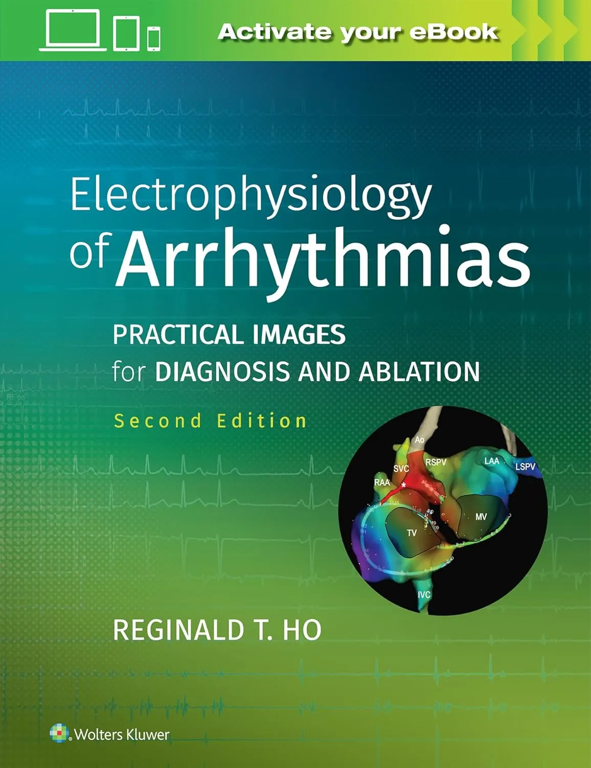 Electrophysiology of Arrhythmias Practical Images for Diagnosis and Ablation | 2nd Edition | Hardcover