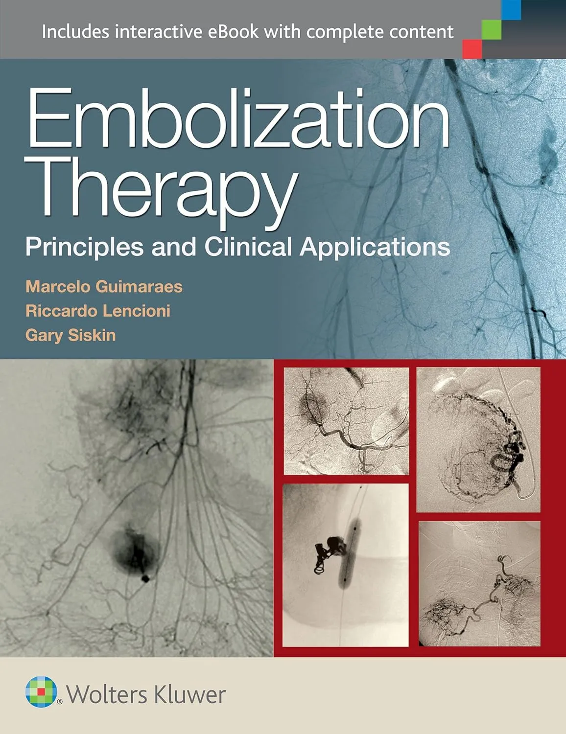 Embolization Therapy Principles and Clinical Applications | Hardcover