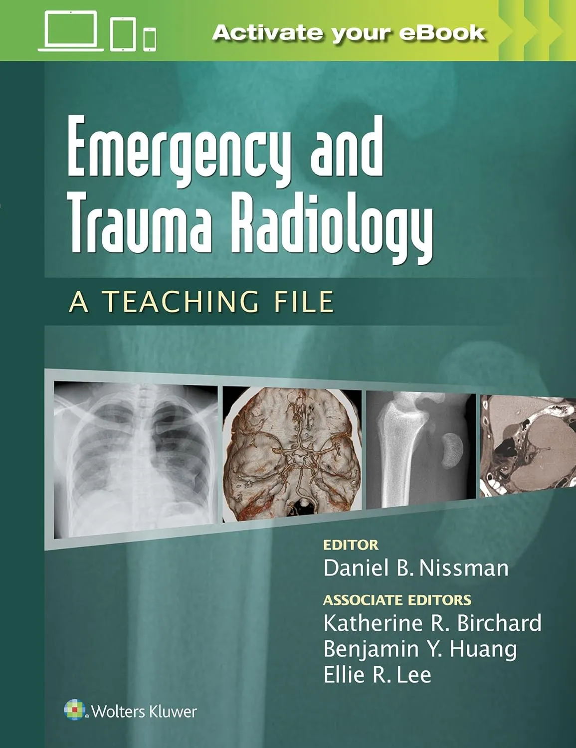 Emergency and Trauma Radiology | Paperback