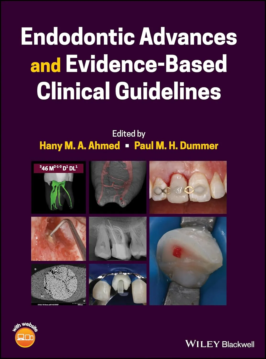 Endodontic Advances And Evidence Based Clinical Guidelines | Hardcover