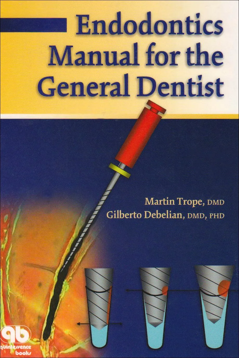 Endodontics Manual for the General Dentist | Paperback