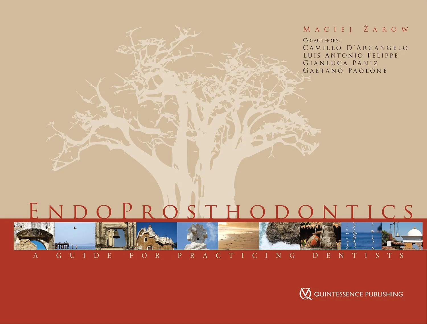 Endoprosthodontics A Guide for Practicing Dentists | Hardcover