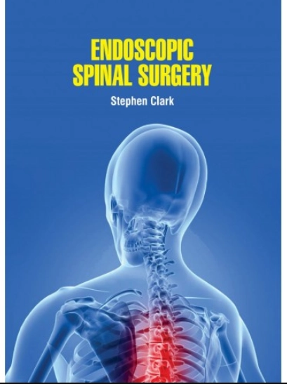 Endoscopic Spinal Surgery | 1st Edition | Hardcover