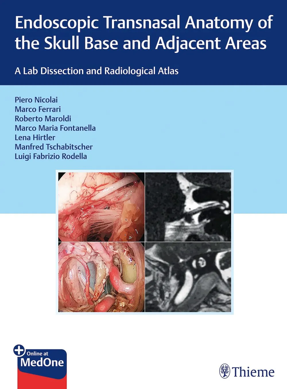 Endoscopic Transnasal Anatomy of the Skull Base and Adjacent Areas | Hardcover