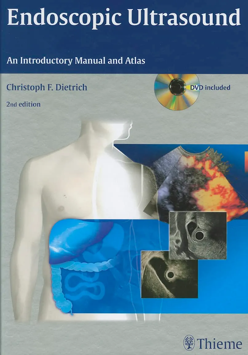 Endoscopic Ultrasound An Introductory Manual and Atlas | 2nd Edition | With DVD | Hardcover