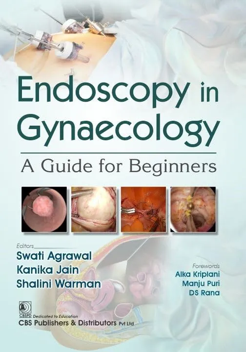 Endoscopy In Gynaecology A Guide For Beginners (Pb 2025)