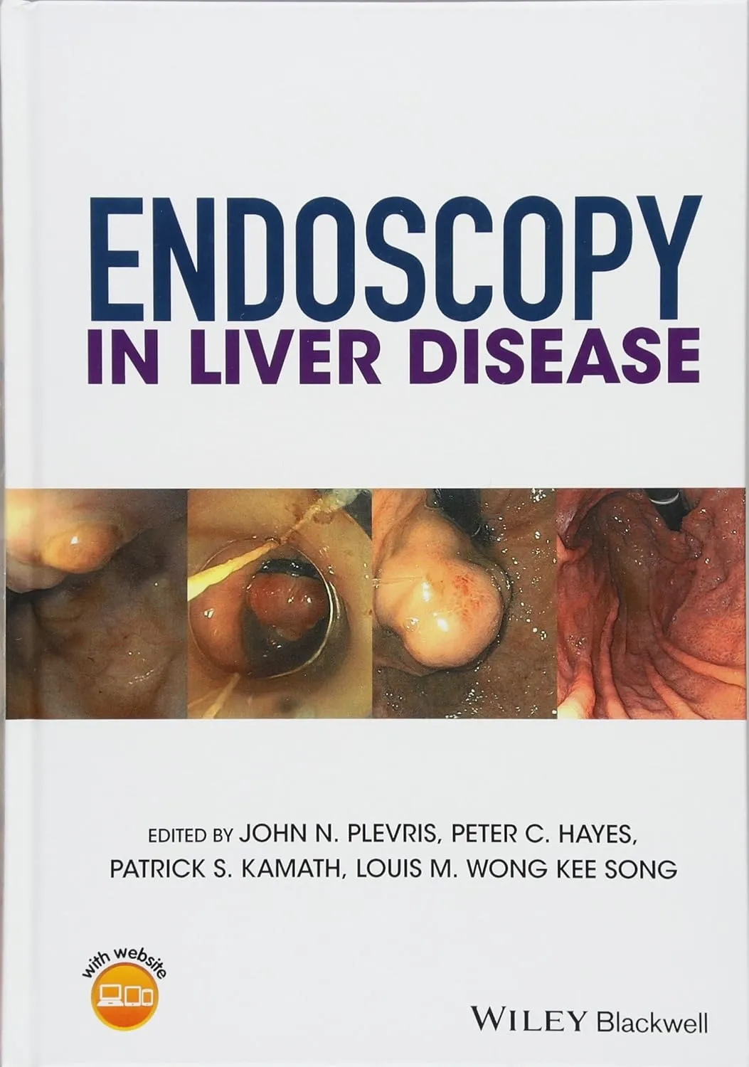Endoscopy in Liver Disease | Hardcover